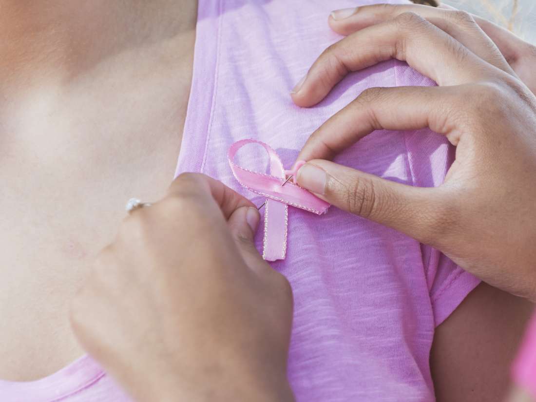 pengobatan kanker payudara