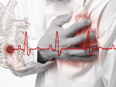 6 Mitos Sakit Jantung yang Banyak DIpercaya, Benar atau Salah?