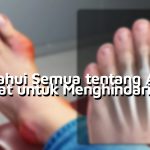 Semua tentang Asam Urat