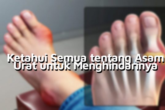 Ketahui Semua tentang Asam Urat untuk Menghindarinya Semua tentang Asam Urat