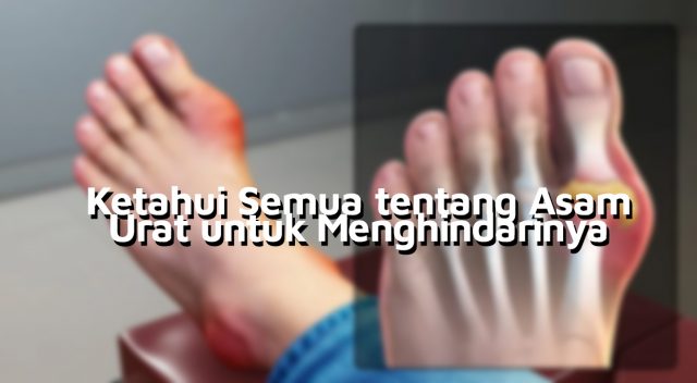 Semua tentang Asam Urat Semua tentang Asam Urat