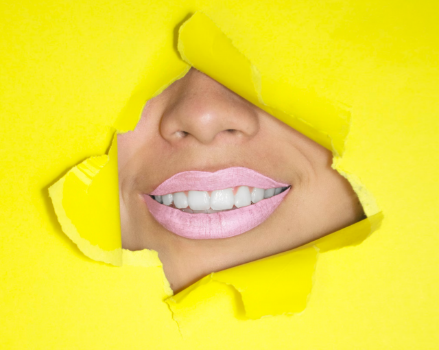 memutihkan gigi memutihkan gigi